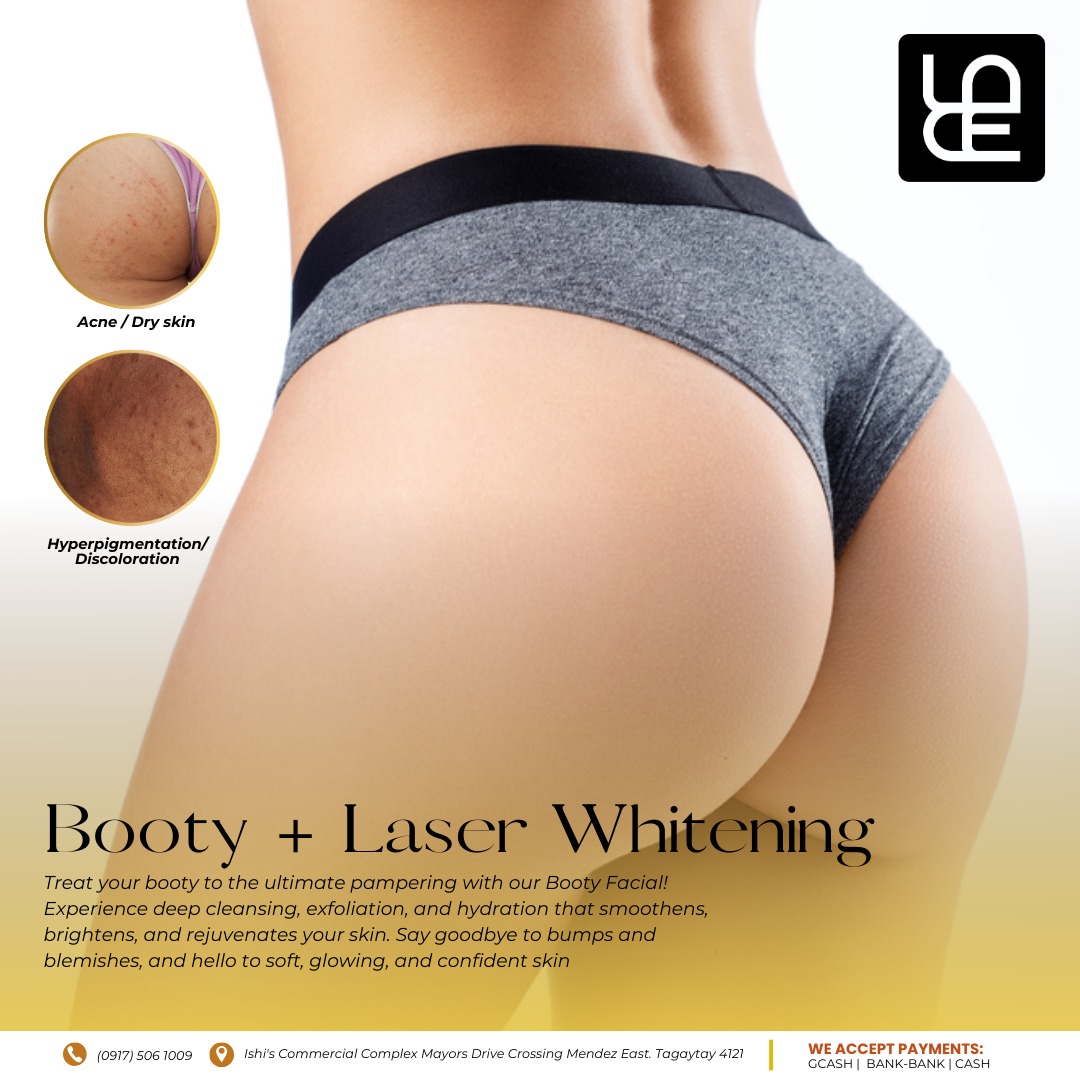 Booty + Laser Whitening